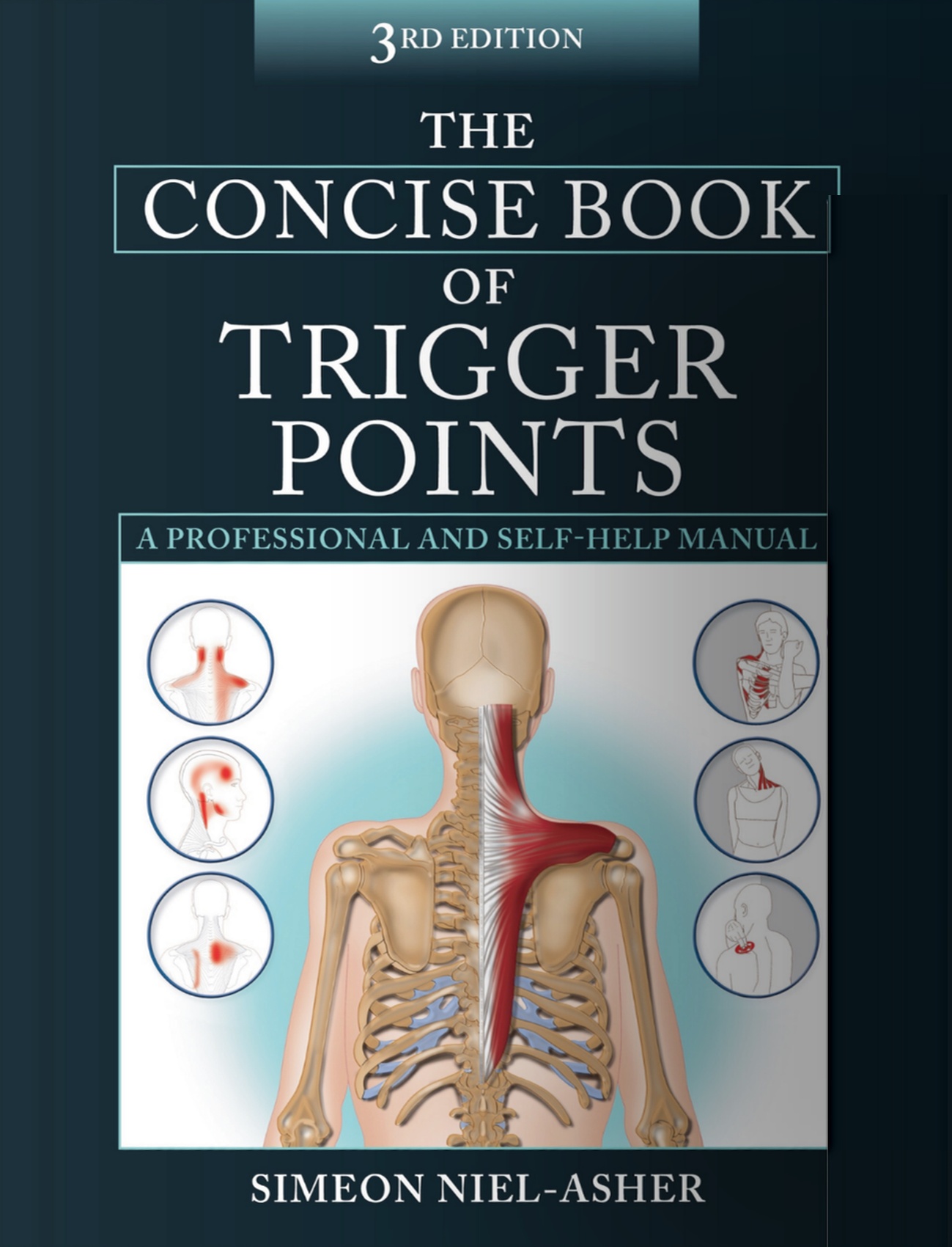 The Concise Book of Trigger Points